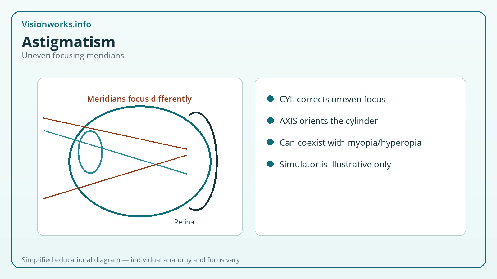 Simplified educational focusing diagram for Astigmatism