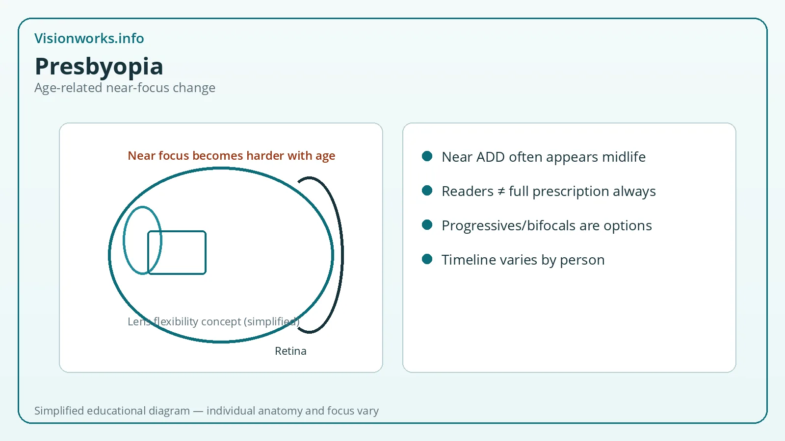 Simplified educational focusing diagram for Presbyopia